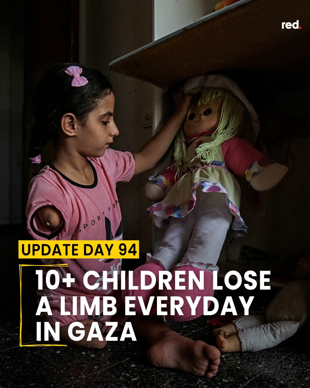 A Gaza almeno dieci bambini ogni giorno subiscono l’ amputazione di un arto (senza anestesia)… intanto arriva Blinken…