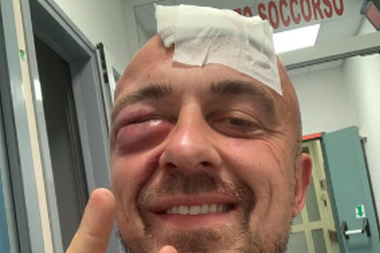 Aggredito chef Rubio, attivista pro Palestina, probabilmente da un gruppo di sionisti.